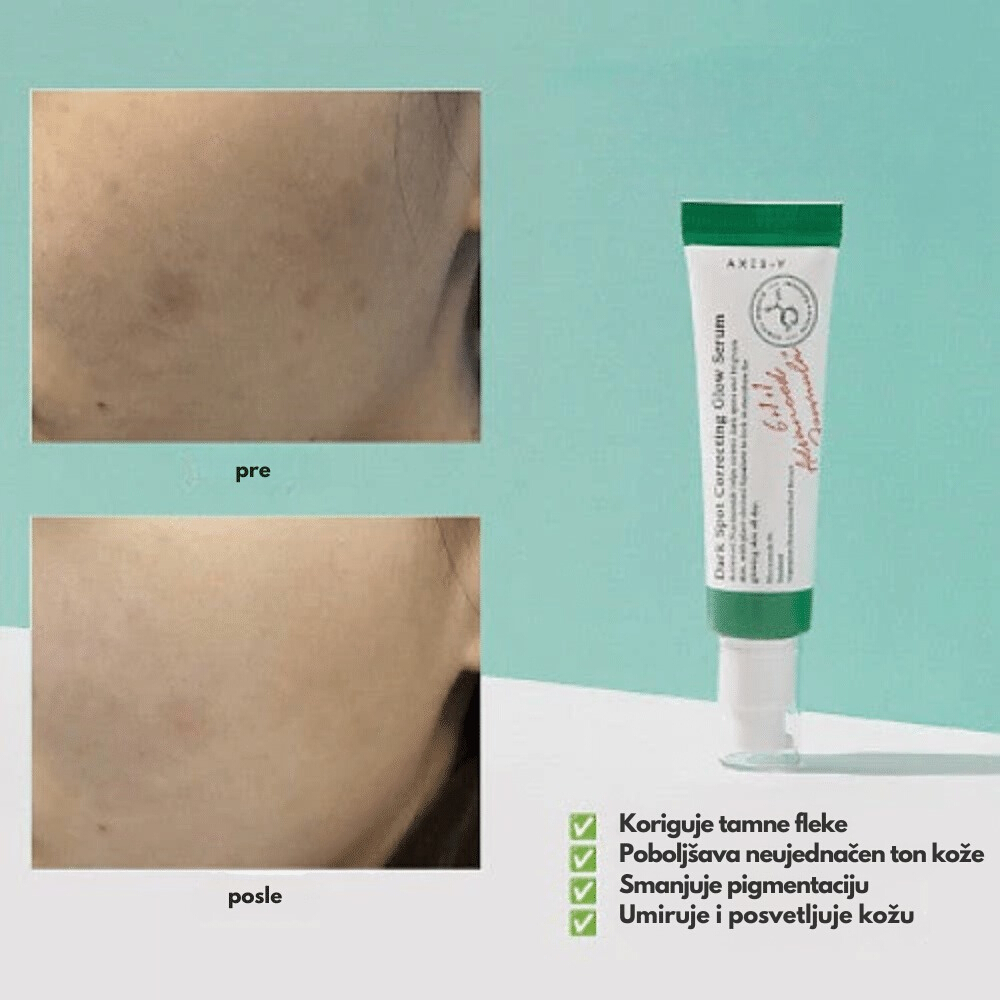 Dark Spot Correcting Glow Serum 50ml