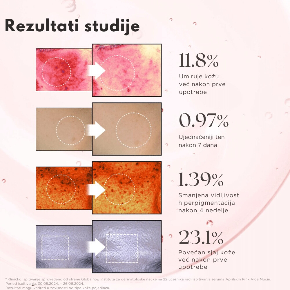 Pink Aloe Mucin Serum 30ml